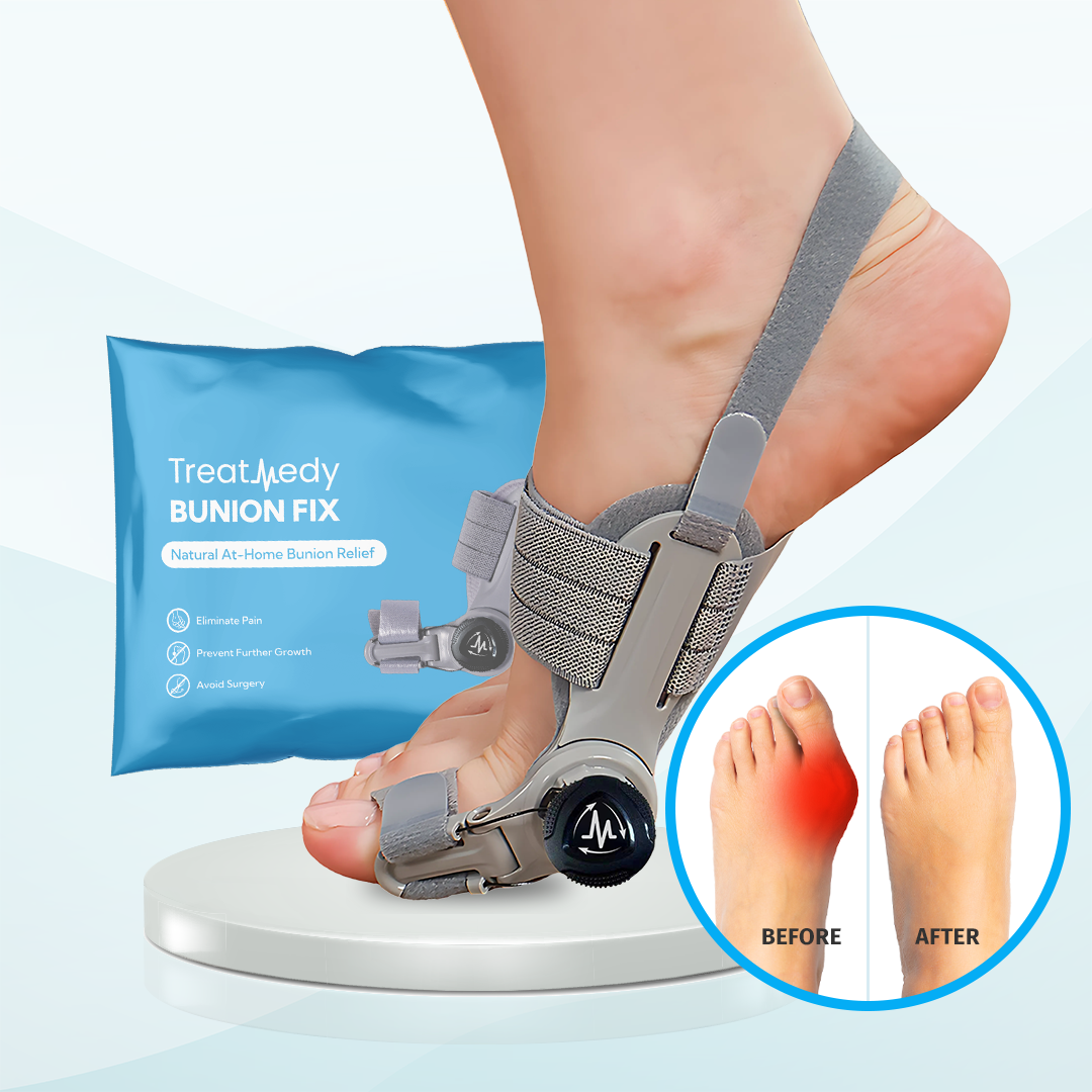 Treatmedy™ Bunion Fix