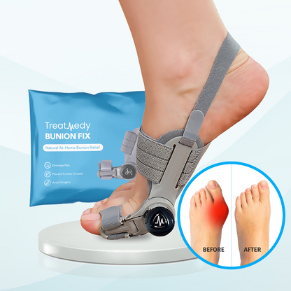 Treatmedy™ Bunion Fix