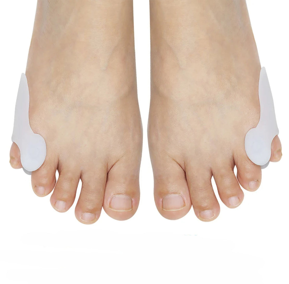 Treatmedy™ Tailor's Bunion Fix